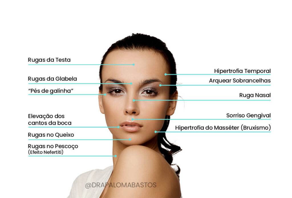 Aplicações da toxina botulínica